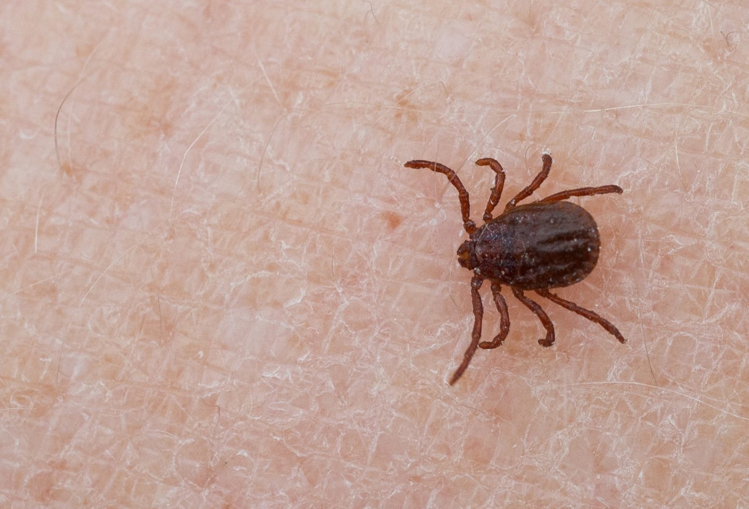 A close-up of a dark brown tick crawling on human skin, showing the insect’s legs and detailed skin texture.