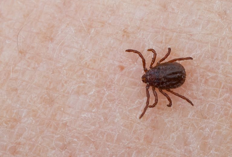 A close-up of a dark brown tick crawling on human skin, showing the insect’s legs and detailed skin texture.